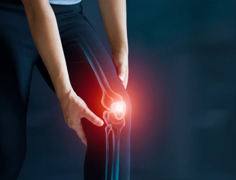 Arthritis Ünik Nutraceuticals. Douleurs au genou dues à l'inflammation